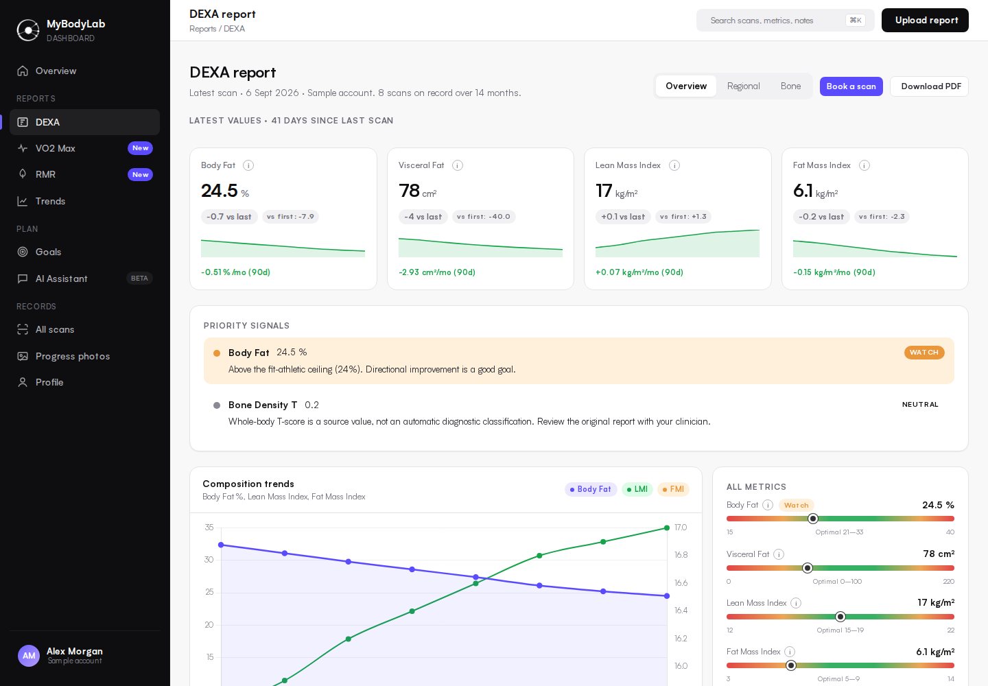 MyBodyLab DEXA report showing body fat, visceral fat, lean mass index and trends